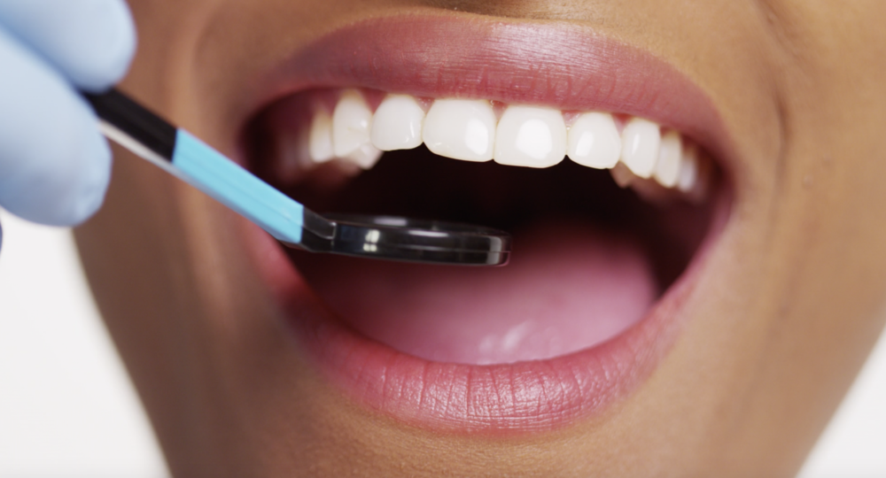 ClearCorrect Aligners at Family Dental Associates